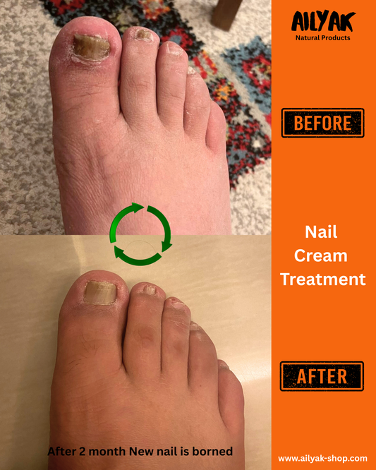 Nail Cream -علاج الاظافر