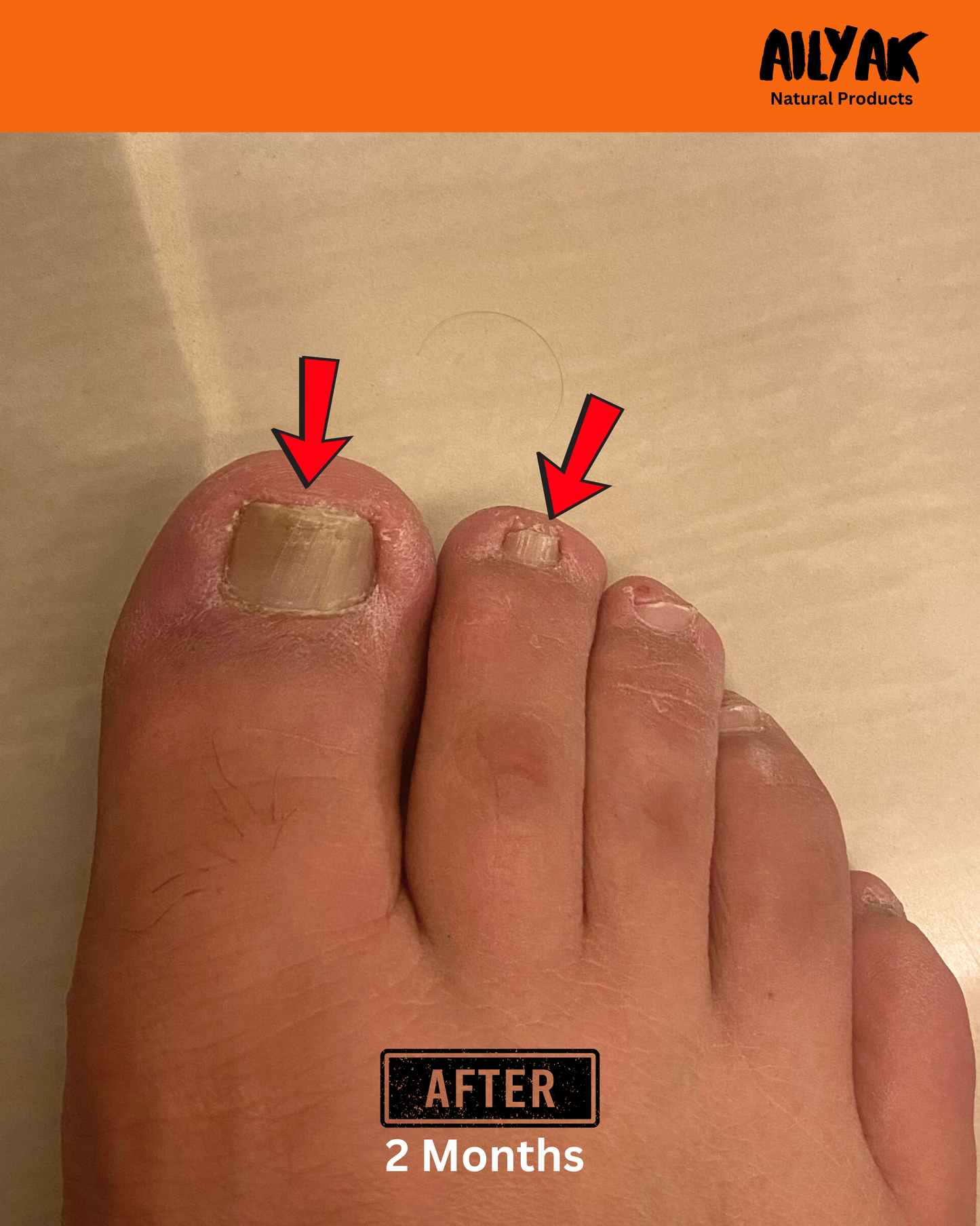 Nail Cream -علاج الاظافر