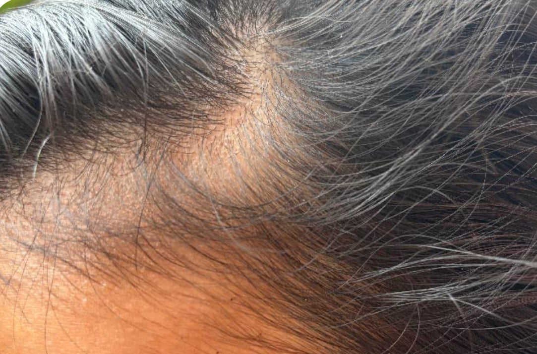 Hair Booster