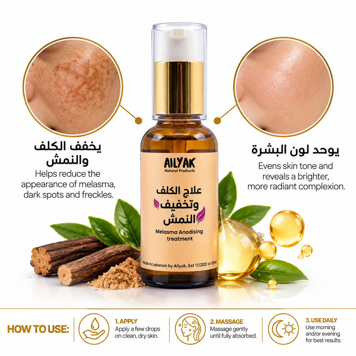 Pigmentation Cream -علاج الكلف والتصبغات