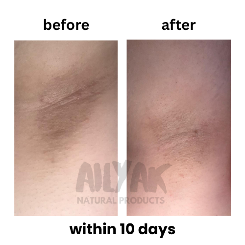 Deodorant + Under arm Scrub