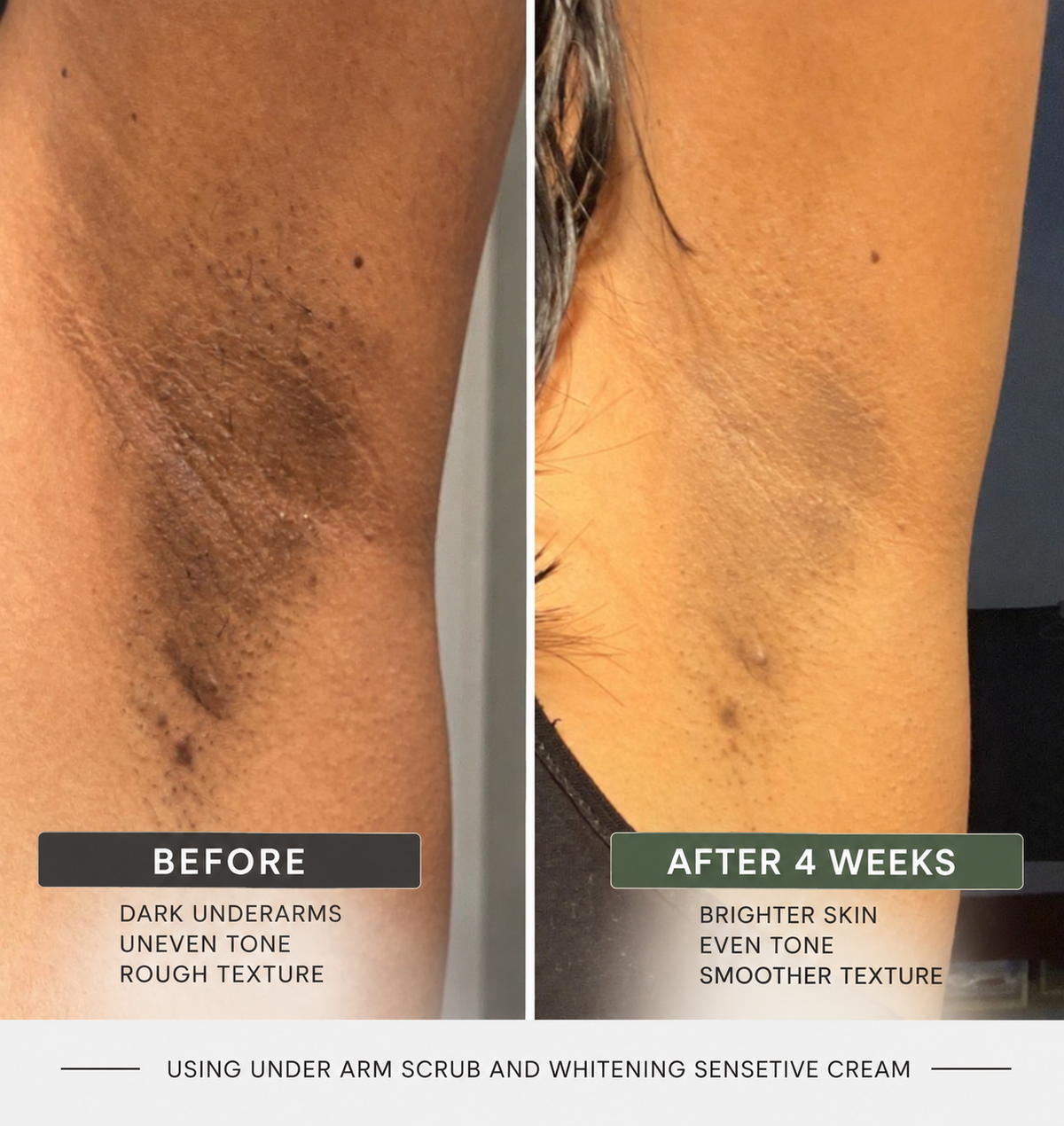 whitening cream + Under arm and Bikini Area)