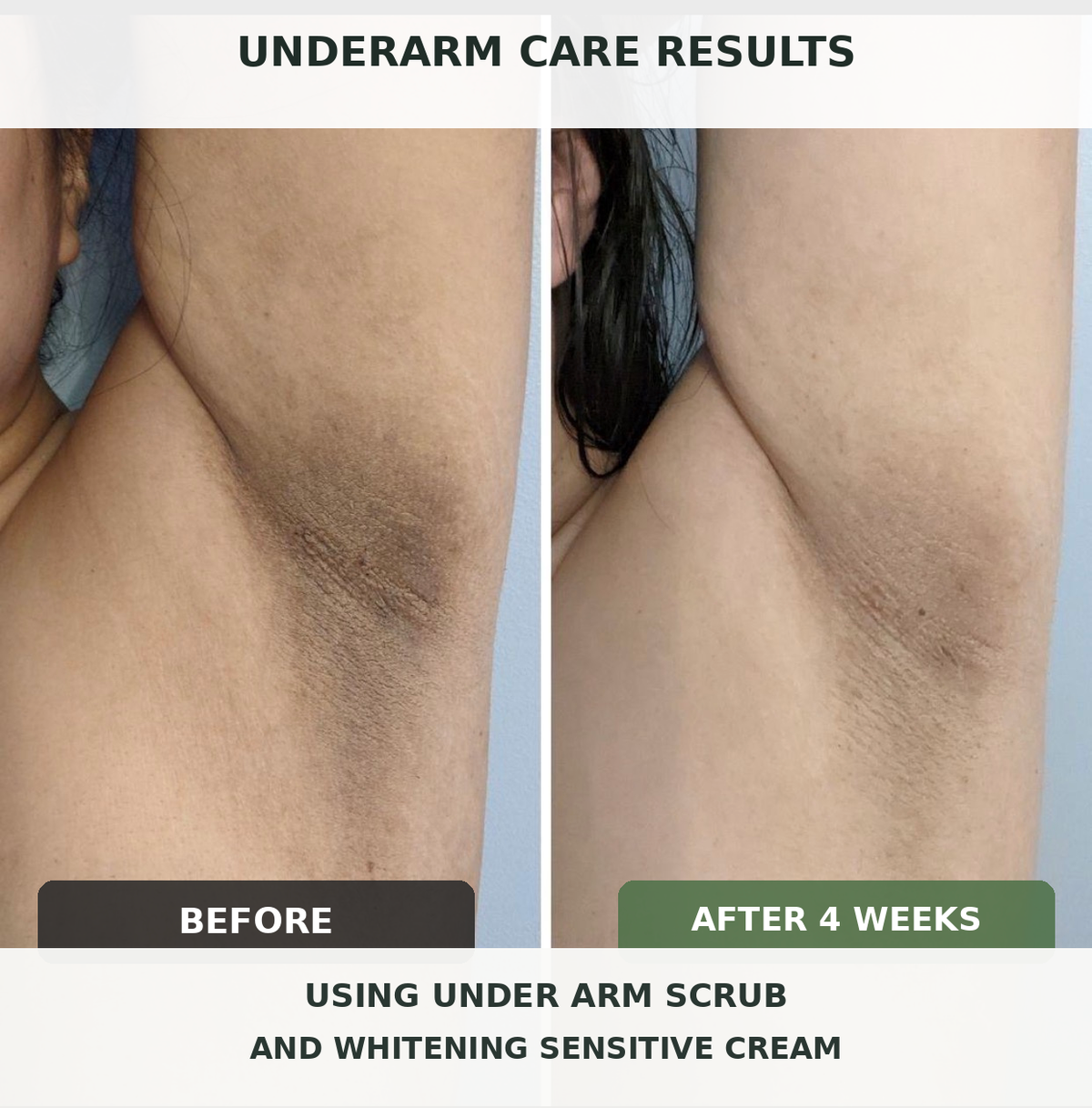 whitening cream + Under arm and Bikini Area)