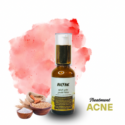 Acne Treatment-علاج الحبوب والبثور