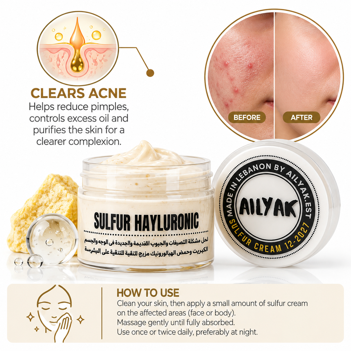 Sulfur hayluronic Acid Cream