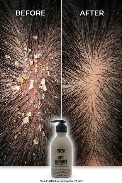 Anti-Dandruff Shampoo 300ml