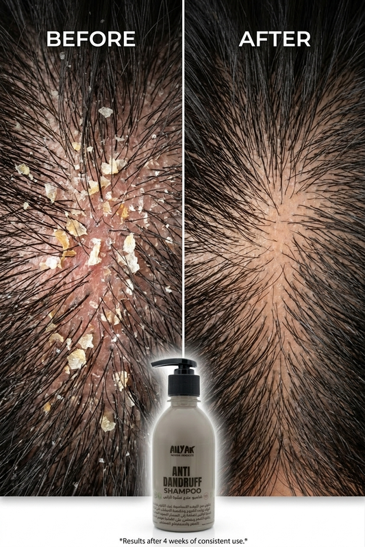 Anti-Dandruff Shampoo 300ml